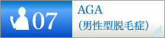 AGA(男性型脱毛症)